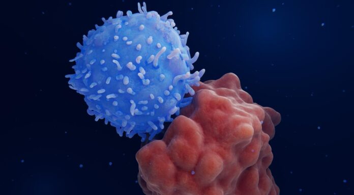 Mélanome de l’œil, l’espoir de nouvelles thérapies