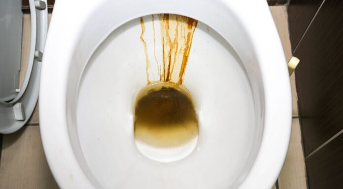 Toilet cleaner ‘works so well’ banishes brown marks without bleach