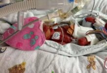 ‘I couldn’t choose which of my twins would live when doctors asked’