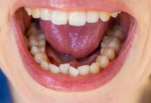 7 reasons you have a ‘metallic ‘ taste in mouth