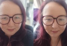 I struggle with rosacea and tested cream that promises to hide redness